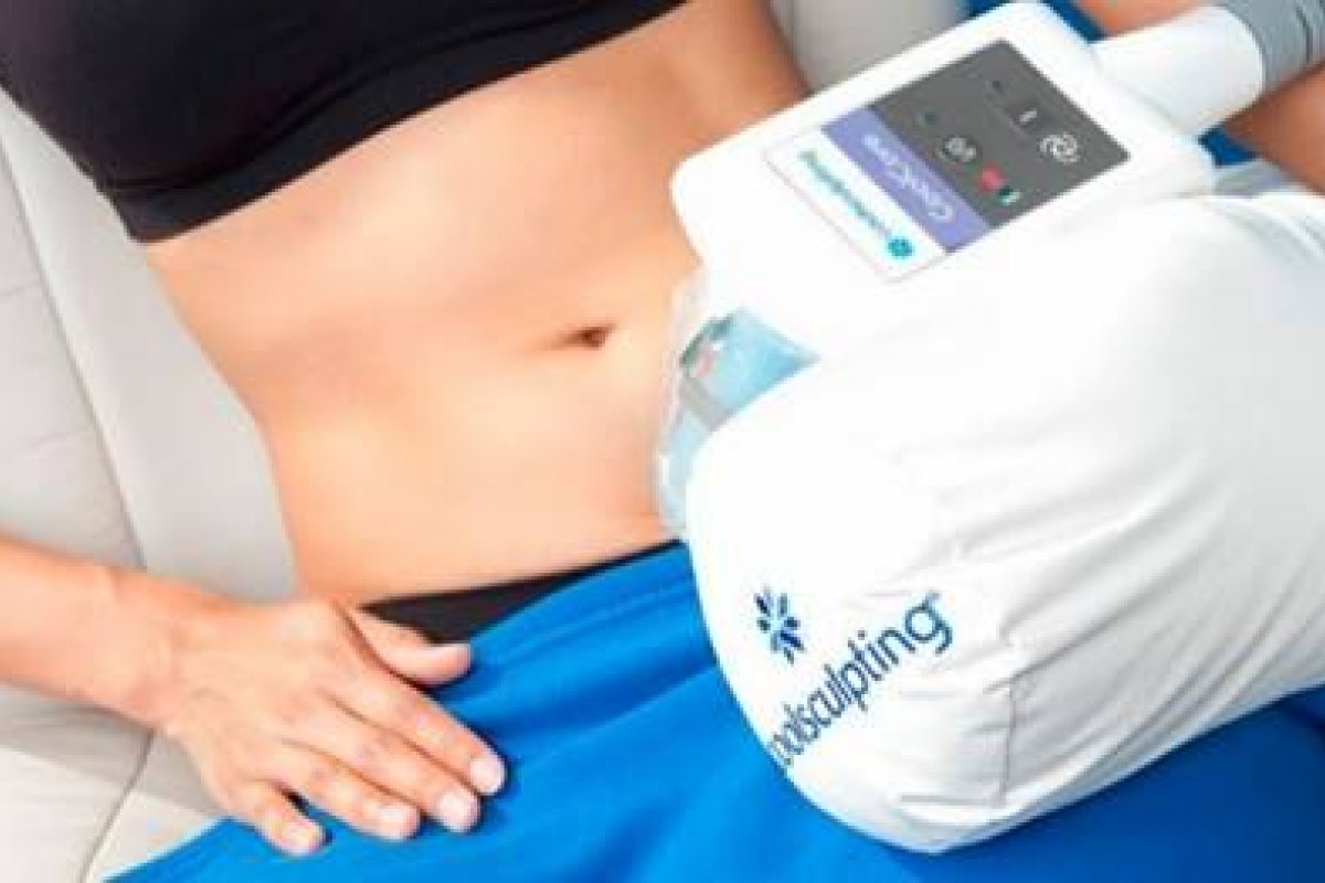 Leia mais sobre o artigo Descubra os Benefícios do CoolSculpting®️ para a Redução de Gordura