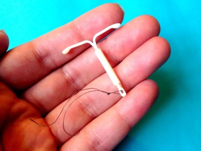 Leia mais sobre o artigo DIU de cobre e prata: vantagens, funcionamento e preservação da fertilidade